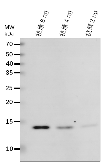 Anti-SNF4/ Sucrose nonfermenting 4-like protein