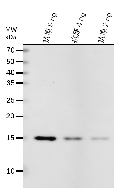 Anti-ECHID/ Enoyl-CoA hydratase/isomerase D