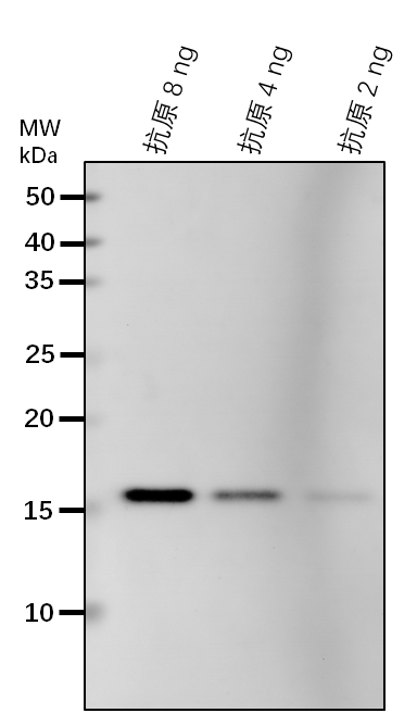 Anti-ACH2/ Acyl-CoA hydrolase 2