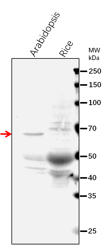 Anti-ASN2/ Asparagine synthetase [glutamine-hydrolyzing] 2