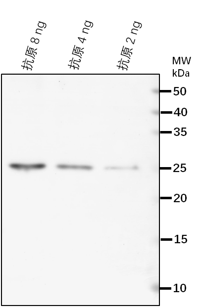 Anti-NAD7/ NADH dehydrogenase subunit 7