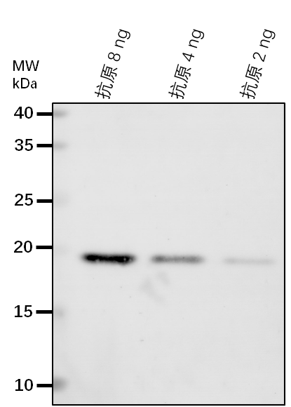 Anti-KEG/ RING-type E3 ubiquitin transferase