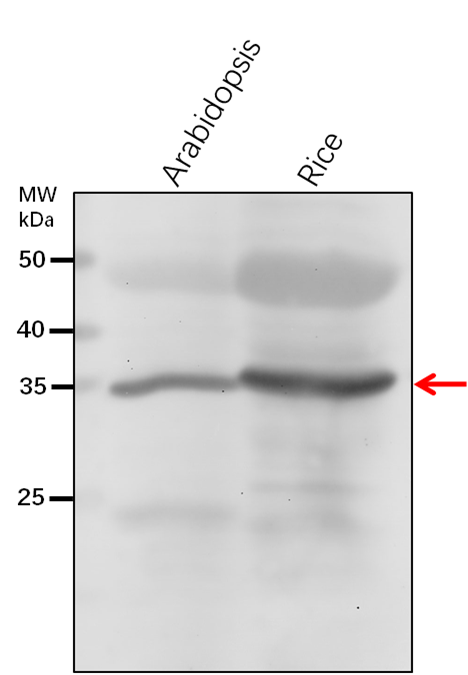 Anti-AGB1/ Guanine nucleotide-binding protein subunit beta