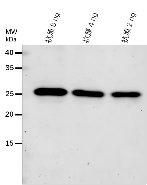 Anti-GLCNAC1PUT2/ UDP-N-acetylglucosamine diphosphorylase 2