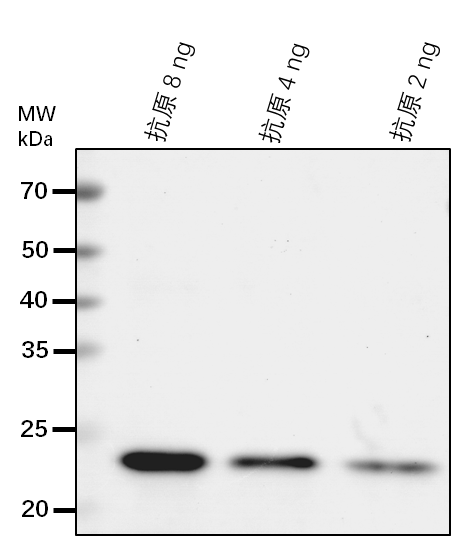 Anti-CSI1/ Protein CELLULOSE SYNTHASE INTERACTIVE 1