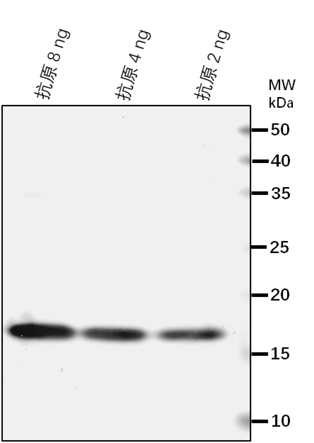 Anti-LYP2/ LysM domain-containing GPI-anchored protein 1