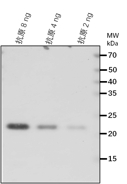 Anti-MGT10/ Magnesium transporter MRS2-11, chloroplastic