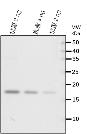 Anti-LPAT2/ 1-acyl-sn-glycerol-3-phosphate acyltransferase 2