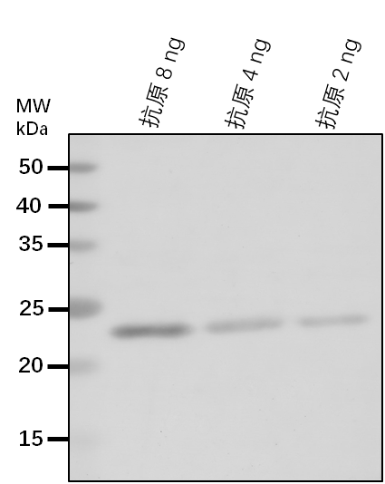 Anti-GCS1/ Mannosyl-oligosaccharide glucosidase GCS1