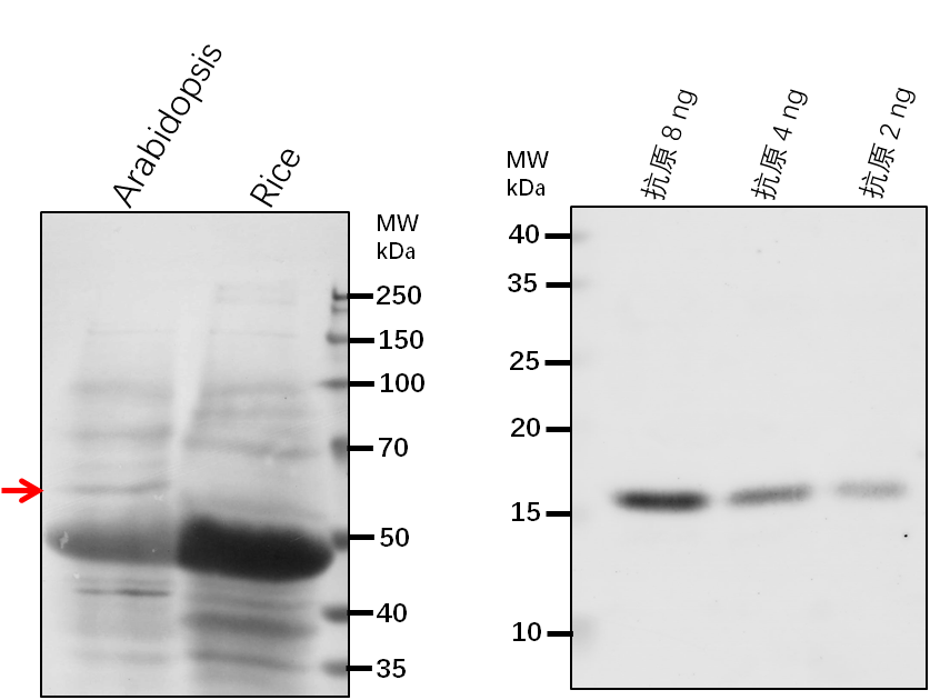 Anti-ETFQO/ ETF-ubiquinone oxidoreductase, mitochondrial