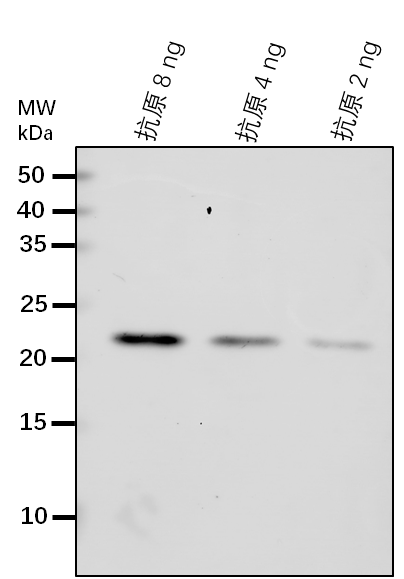 Anti-SUVH9/ Histone-lysine N-methyltransferase family member