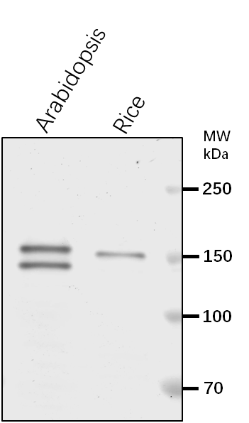 Anti-TPP2/ Tripeptidyl-peptidase 2