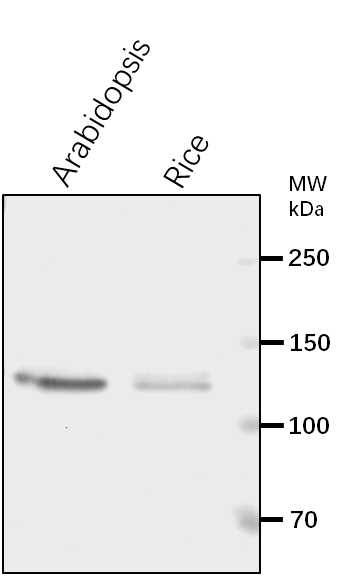 Anti-UBA1/ Ubiquitin-activating enzyme E1 1