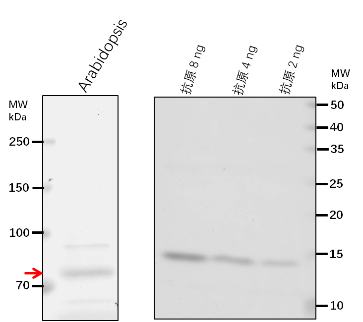 Anti-LACS1/ Long chain acyl-CoA synthetase 1