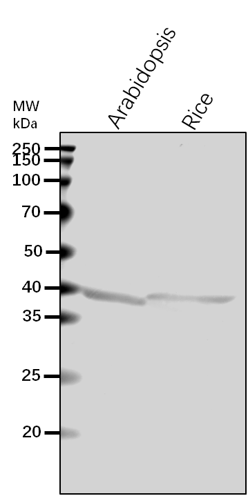 Anti-AGT1/ Serine--glyoxylate aminotransferase