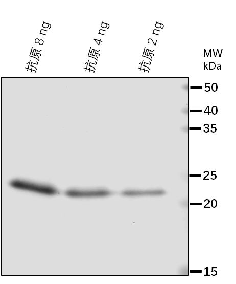 Anti-HOP2/ Hsp70-Hsp90 organizing protein 2