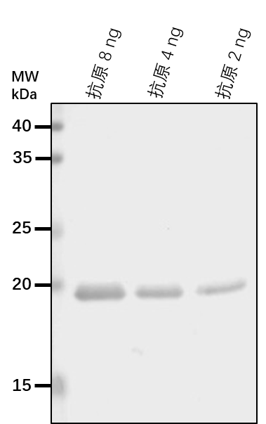 Anti-SCN1/GDI1/ Rho GDP-dissociation inhibitor 1