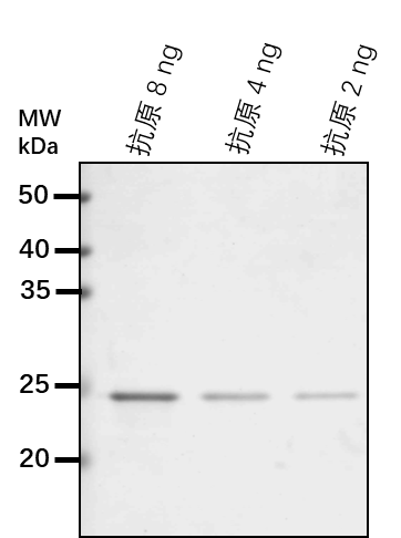 Anti-VHA-B/ V-type proton ATPase subunit B