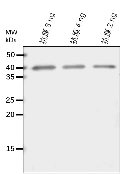 Anti-ACBP1/ Acyl-CoA-binding domain-containing protein 1