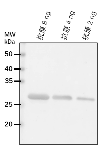 Anti-PDK/ [Pyruvate dehydrogenase (acetyl-transferring)] kinase, mitochondrial