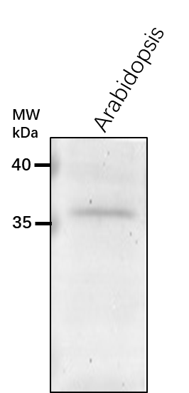 Anti-UFD1/ Ubiquitin fusion degradation protein 1 B