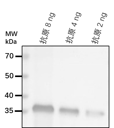 Anti-SMT1/ Cycloartenol-C-24-methyltransferase