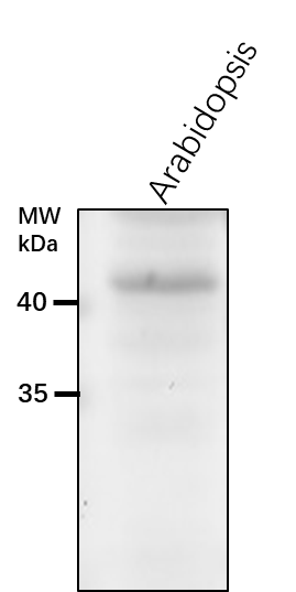 Anti-SQS1/ Squalene synthase 1