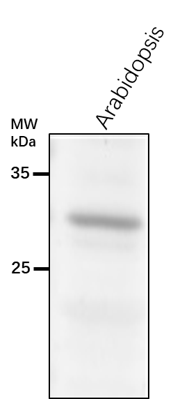 Anti-SDRB/ Short-Chain Dehydrogenase Reductase B